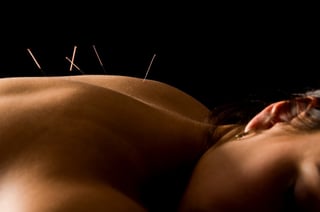 acupuncture.jpg